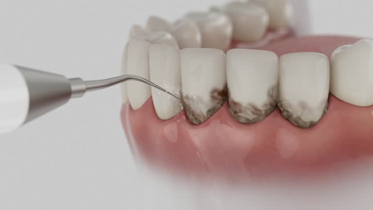 Trusted Teeth Cleaning And Checkup service in Braidwood, IL - Dentist Open Now